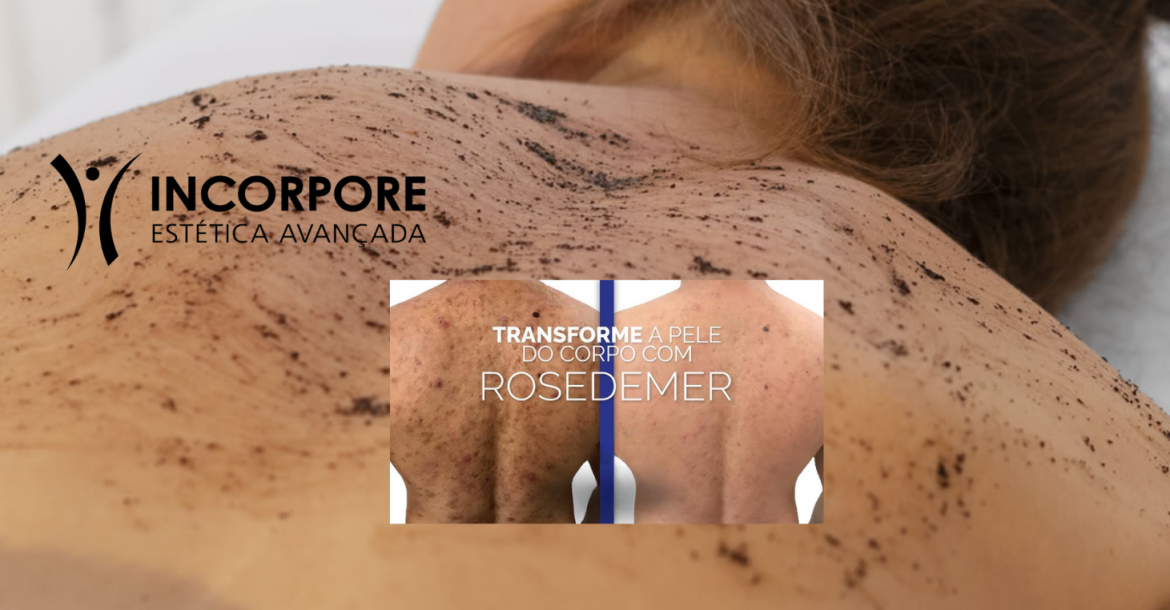HEADER Costas Peeling Rose de Mer Corporal SITE NOVO 2025 (1461 x 1174 px) (1) HEADER Costas Peeling Rose de Mer Corporal SITE NOVO 2025 (1461 x 1174 px) (1)