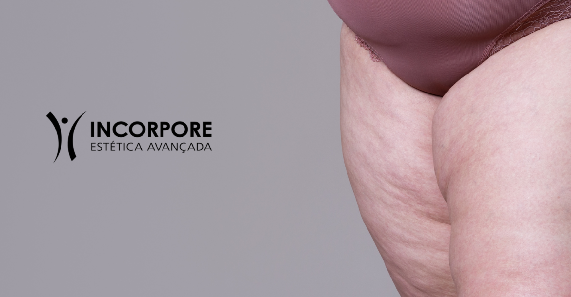 HEADER LIPEDEMA SITE NOVO 2025 (1461 x 1174 px) HEADER LIPEDEMA SITE NOVO 2025 (1461 x 1174 px)