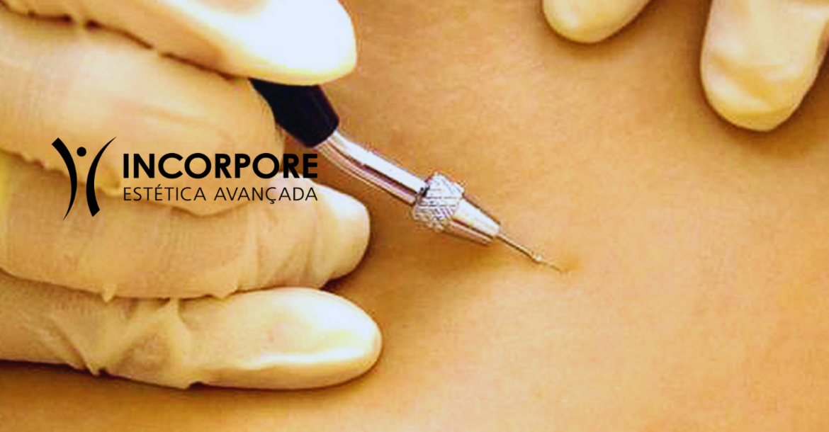 HEADER Microgalvanopuntura SITE NOVO 2025 (1461 x 1174 px) HEADER Microgalvanopuntura SITE NOVO 2025 (1461 x 1174 px)