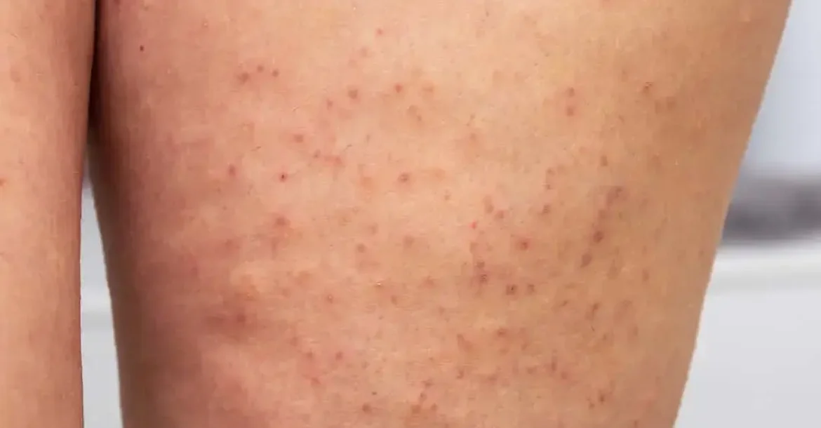 istock-1438920428[1]